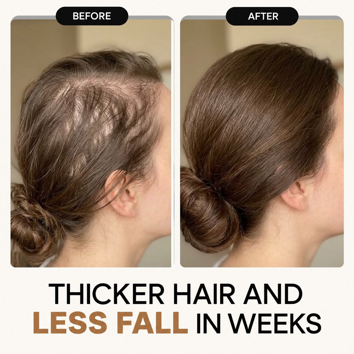 HOK Rosemary & Rice Water Hair Growth Spray HOK