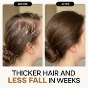 HOK Rosemary & Rice Water Hair Growth Spray HOK