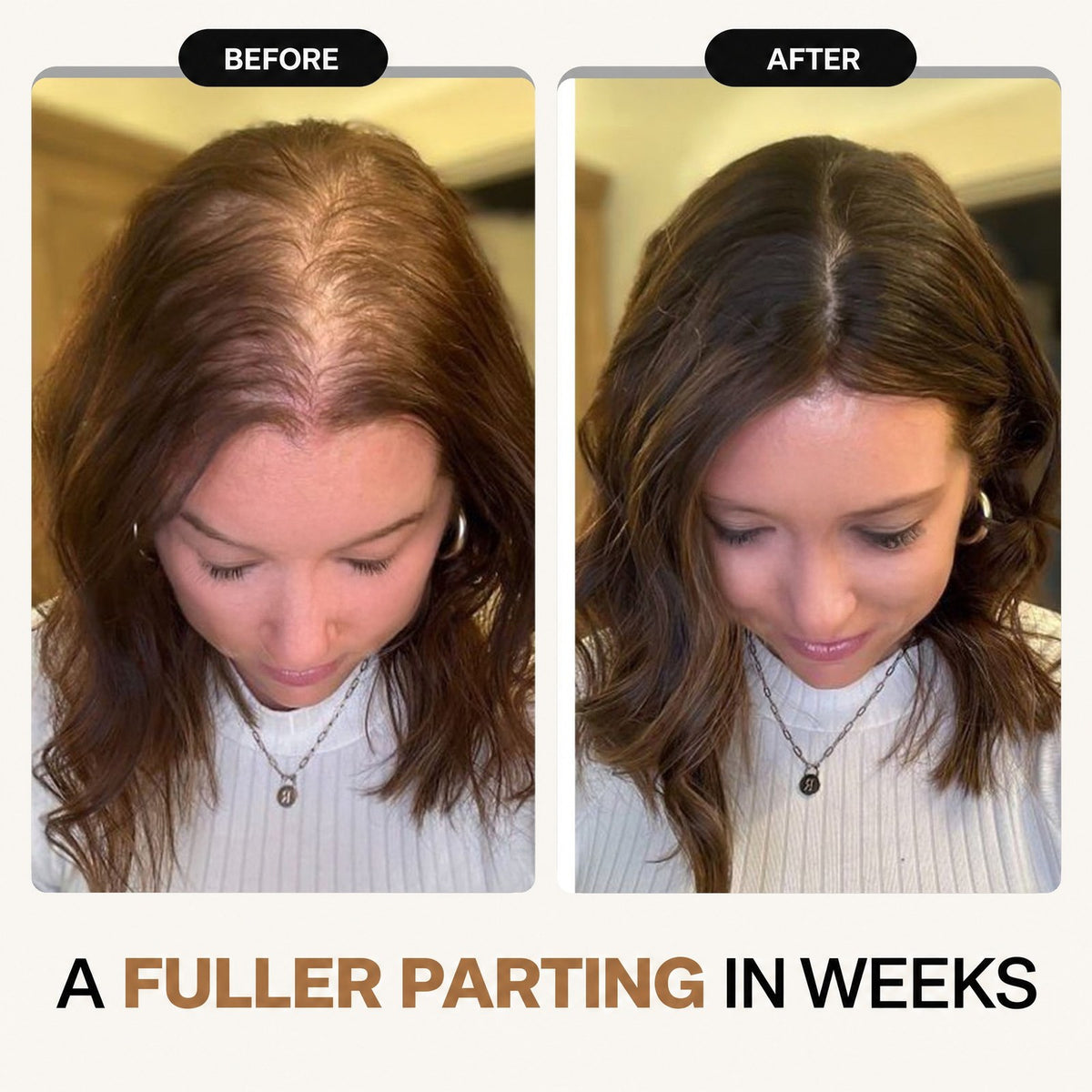 HOK Rosemary & Rice Water Hair Growth Spray HOK