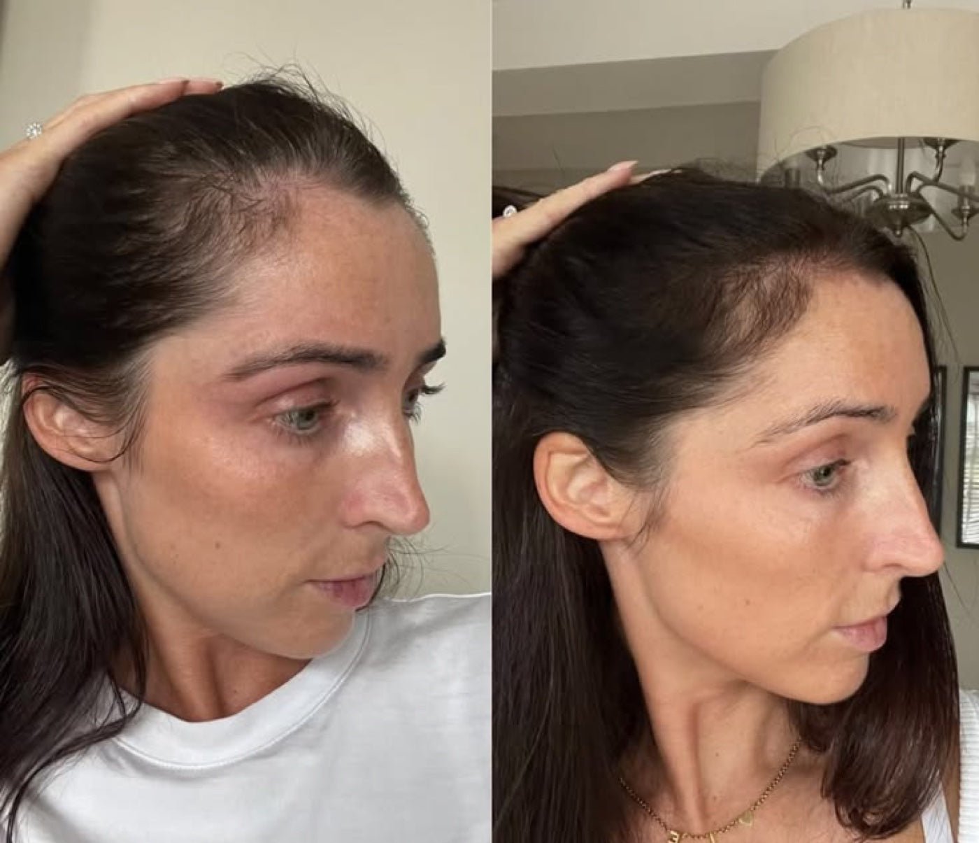 Baby hairs along the hairline