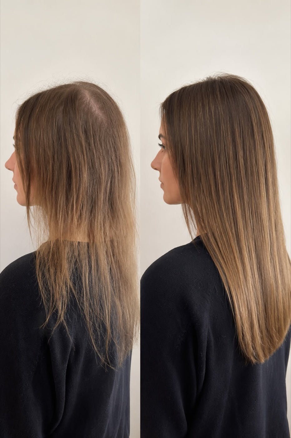 Scalp covered, fuller crown