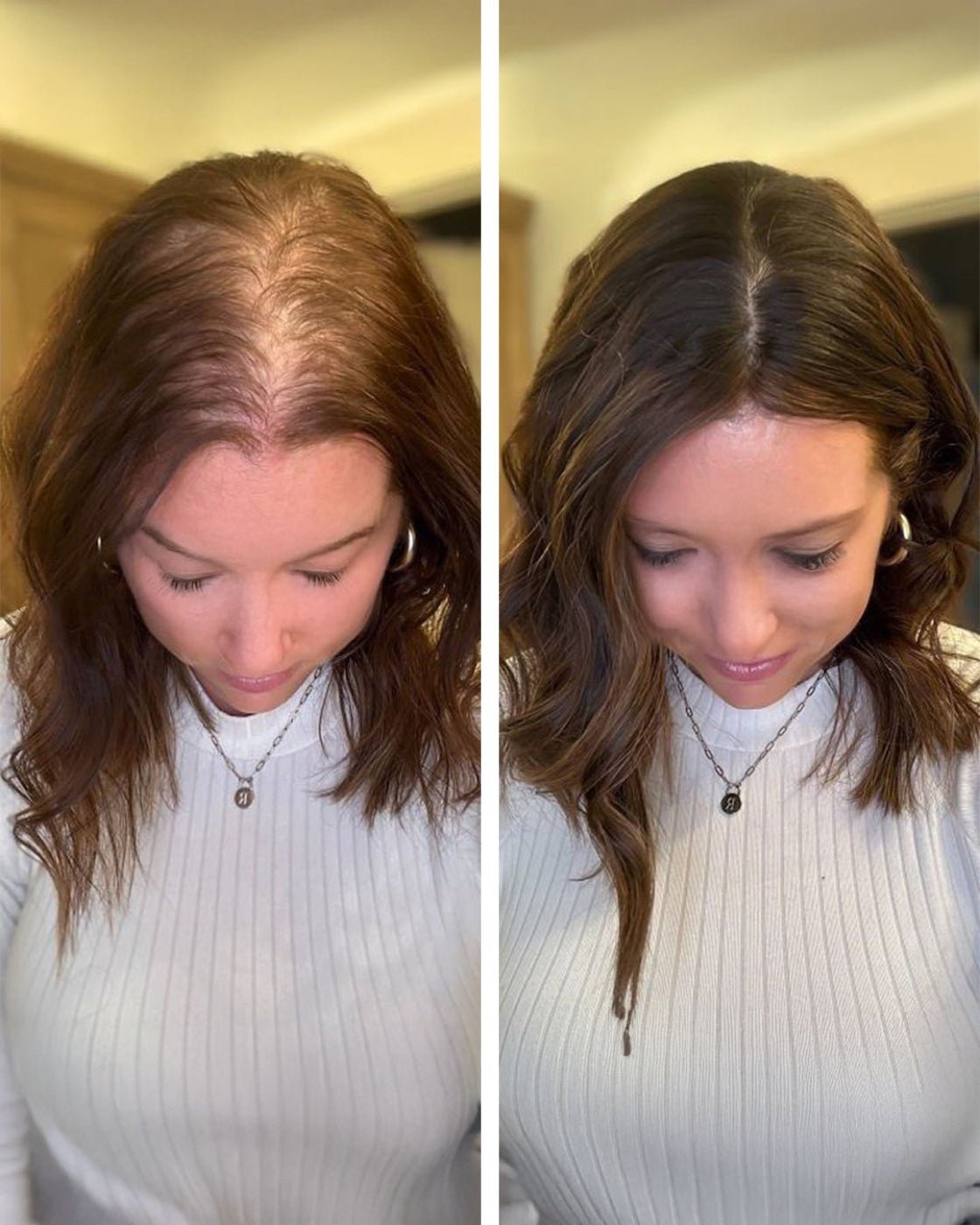 Narrower parting, denser roots